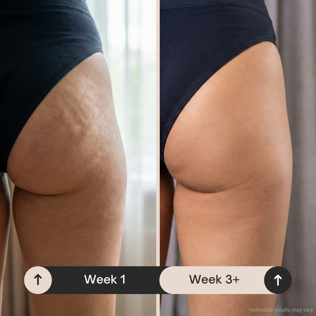 Outer thigh before and after