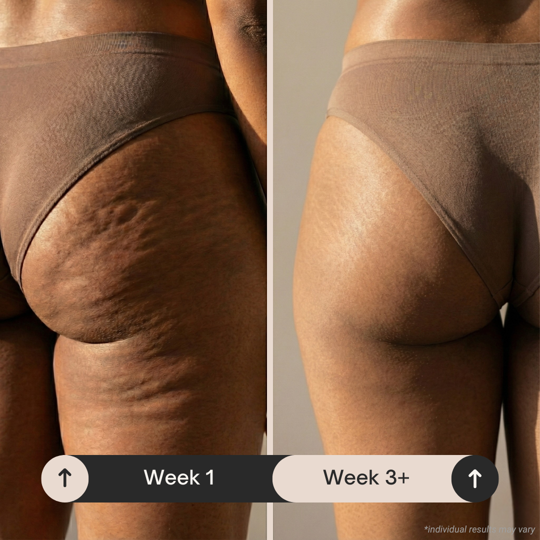 Under-butt before and after