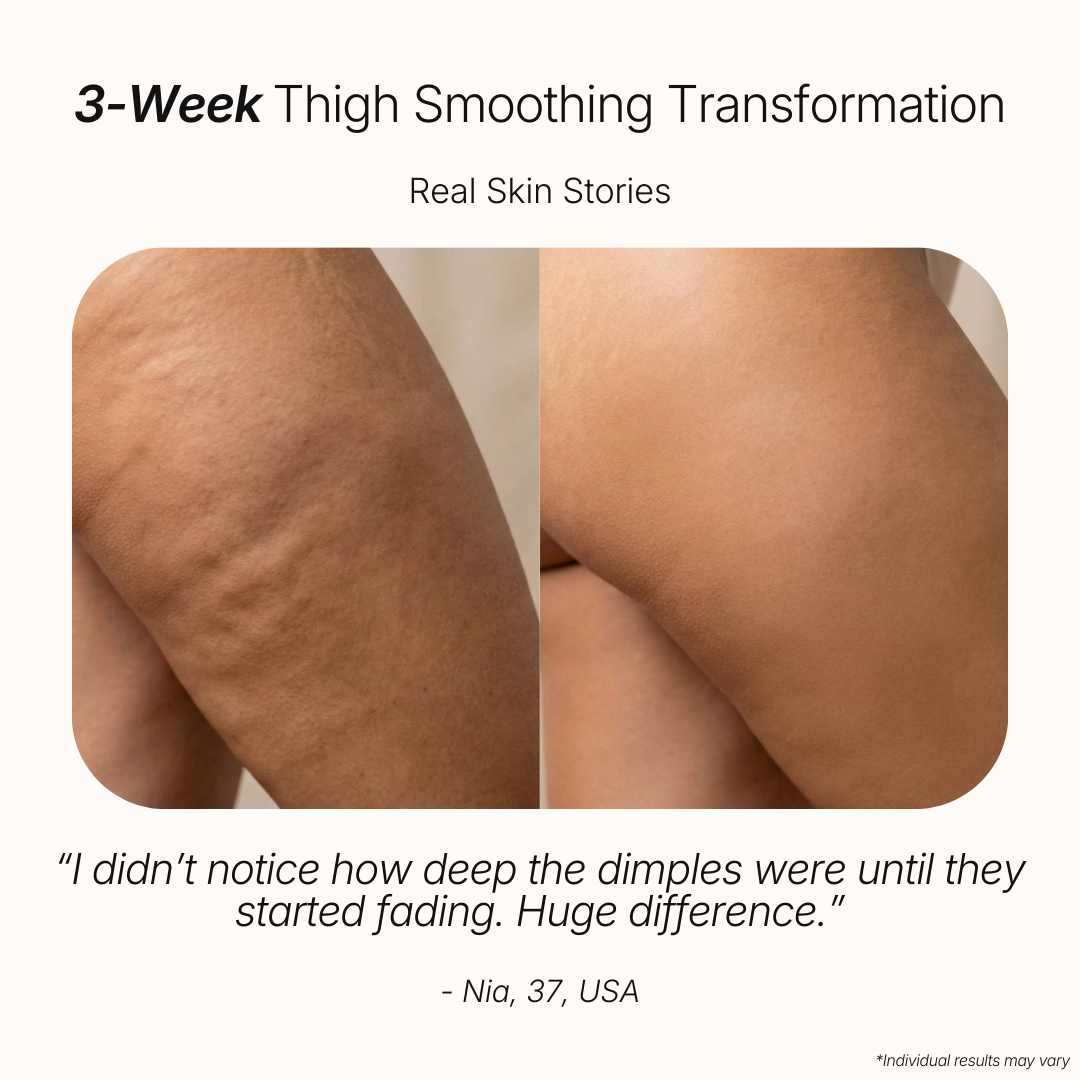 Anti-Cellulite Massage Oil