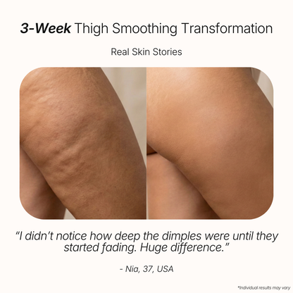 Anti-Cellulite Massage Oil