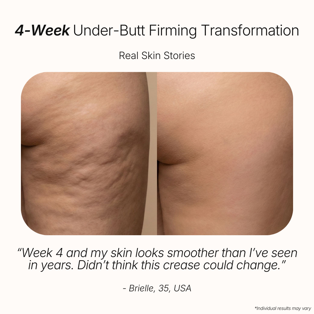 Anti-Cellulite Massage Oil