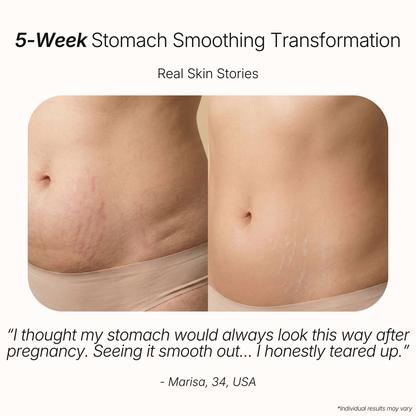 Anti-Cellulite Massage Oil