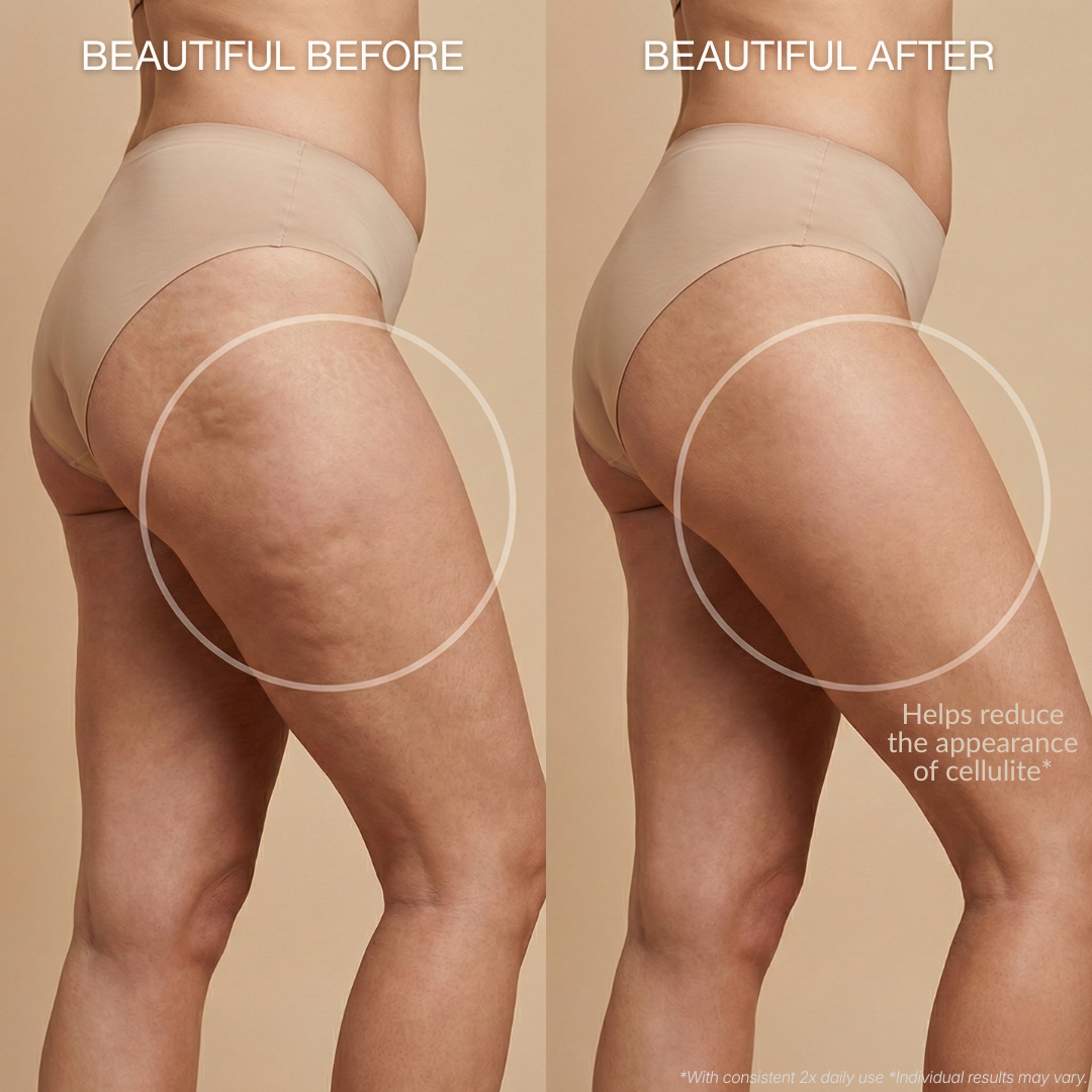 Anti-Cellulite Massage Oil