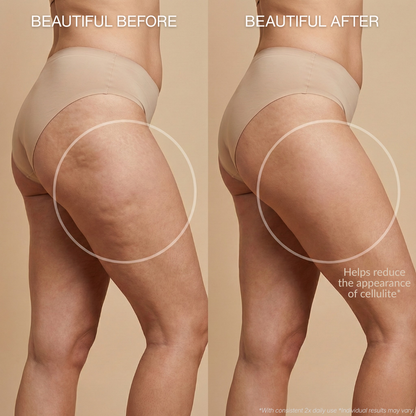 Anti-Cellulite Massage Oil