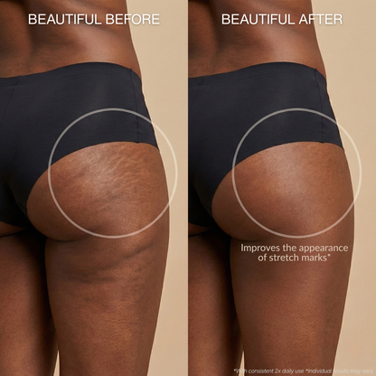 Anti-Cellulite Massage Oil